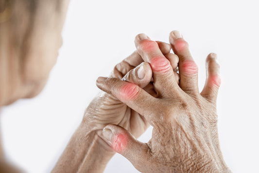 Beyond the Joints: How Inflammatory Arthritis Affects Overall Health and Wellness