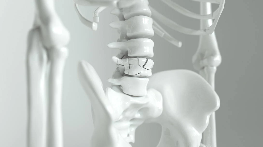 Unlocking the Secrets of Strong Bones: Beyond Bone Density – Marah Natural